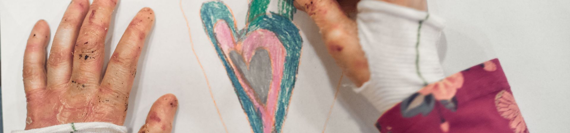 EB-Betroffene malt ein Herz mit Wachsmalstiften